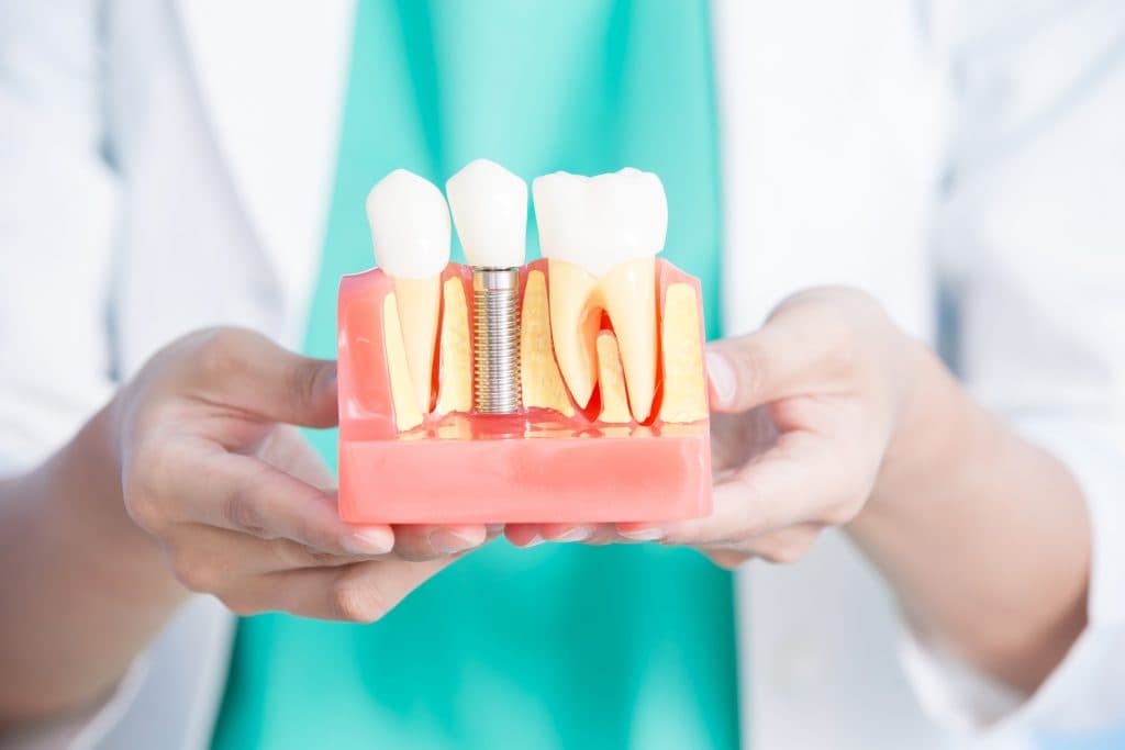 Implant